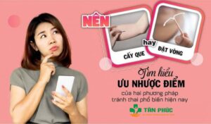 Nên tránh thai bằng đặt vòng hay cấy que?