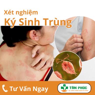 Nhiễm ký sinh trùng: Nguyên nhân, dấu hiệu, chẩn đoán và điều trị