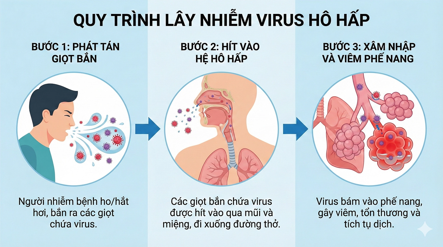 Sơ đồ mô tả con đường lây nhiễm của virus gây viêm phổi, từ giọt bắn trong không khí đến việc tấn công các phế nang phổi.