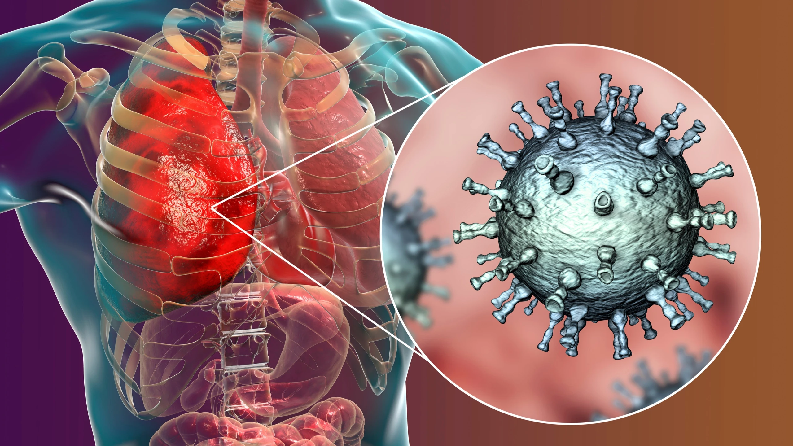 Viêm Phổi Do Virus: 5 Triệu Chứng Cảnh Báo & Cách Chăm Sóc An Toàn Tại Nhà
