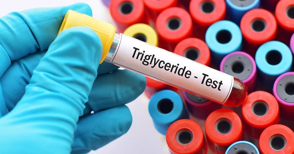 Chỉ Số Triglyceride Cao Là Gì? 5 Cách Hạ Mỡ Máu Nhanh